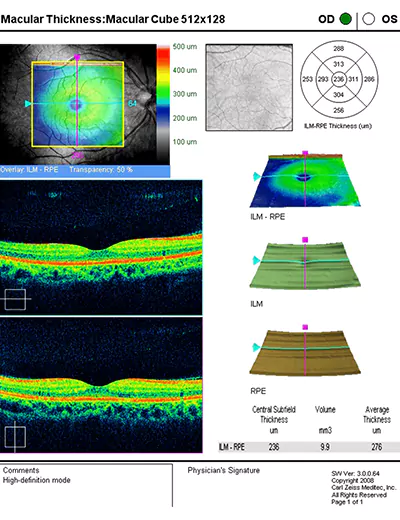 Equipment-OCT-Result